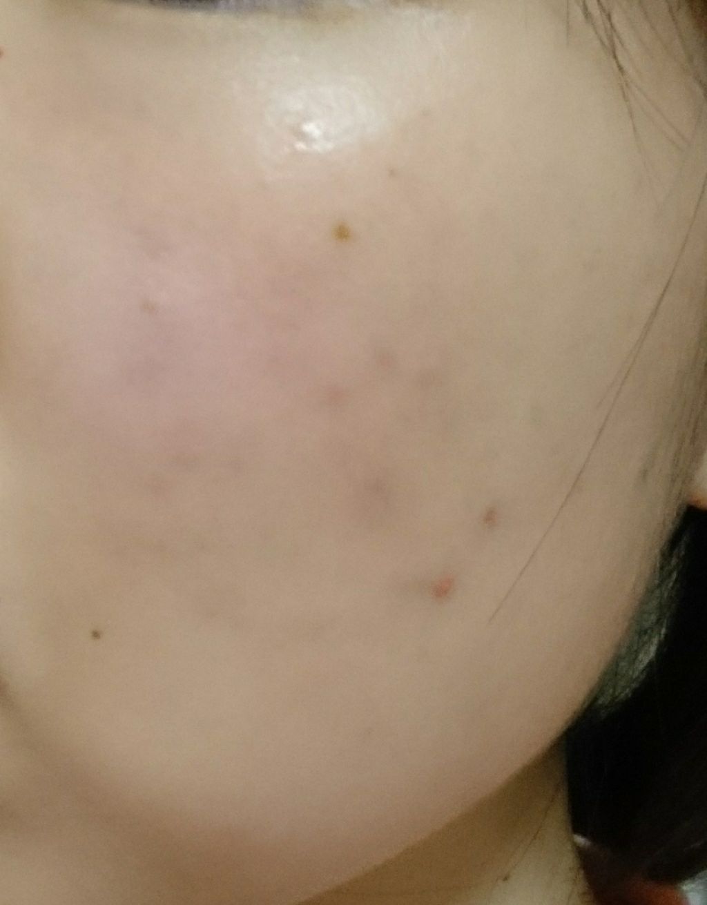 ポジティブソリューション/LUNASOL/美容液を使ったクチコミ(3枚目)