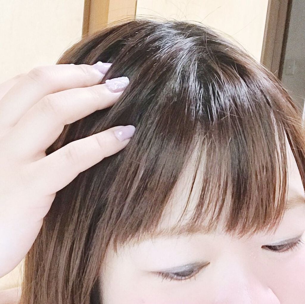 メディカルスカルプスパエッセンス/ティアレラプラス/頭皮ローションを使ったクチコミ(5枚目)