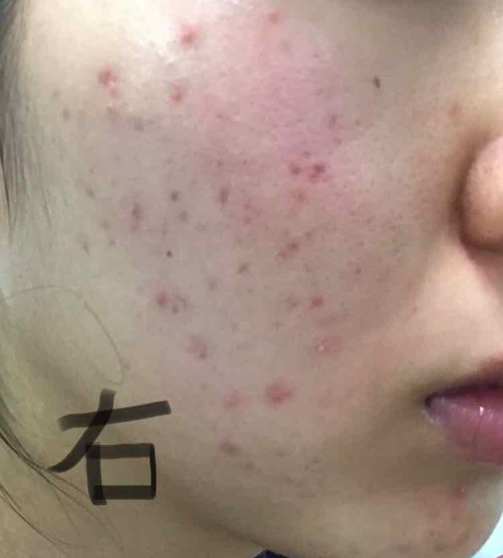 DHC 亜鉛/DHC/健康サプリメントを使ったクチコミ(2枚目)