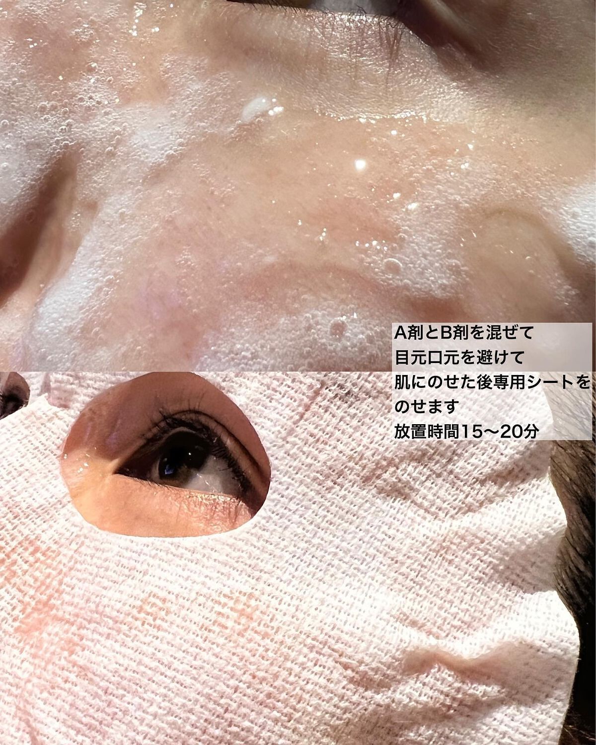 スパークリングパック/Urar /シートマスク・パックを使ったクチコミ（3枚目）