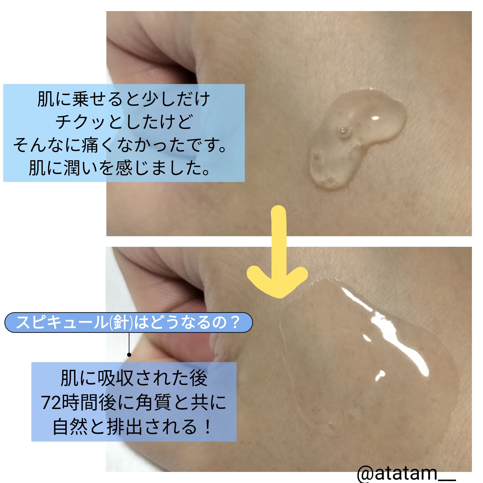 RTXセラム ヒアルショット/Dr.G/美容液を使ったクチコミ（2枚目）