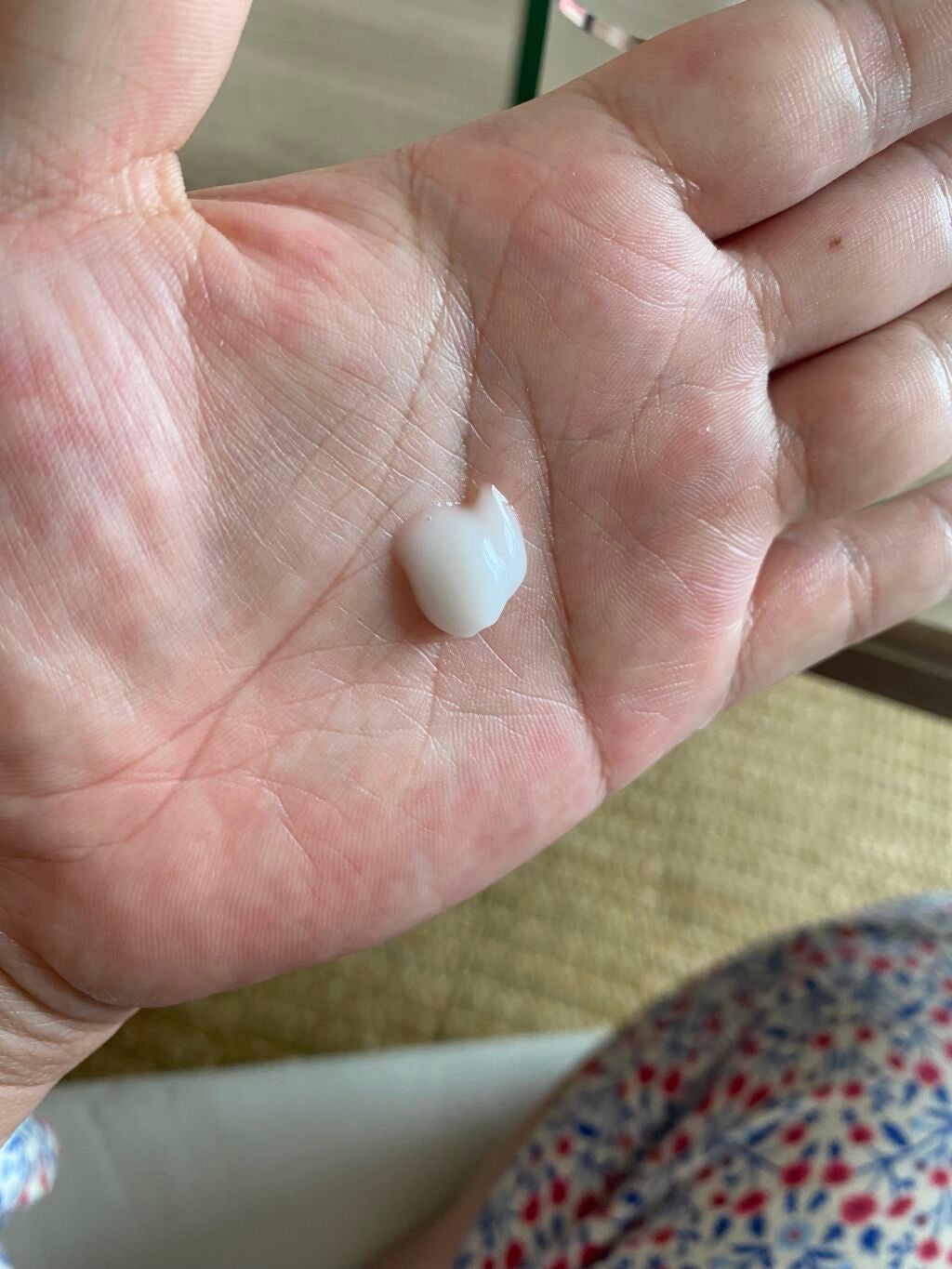 ACC 薬用アクネジェル/ETUDE/フェイスクリームを使ったクチコミ(2枚目)