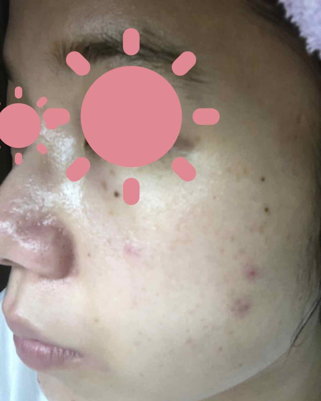 オバジC10セラム/オバジ/美容液を使ったクチコミ(3枚目)