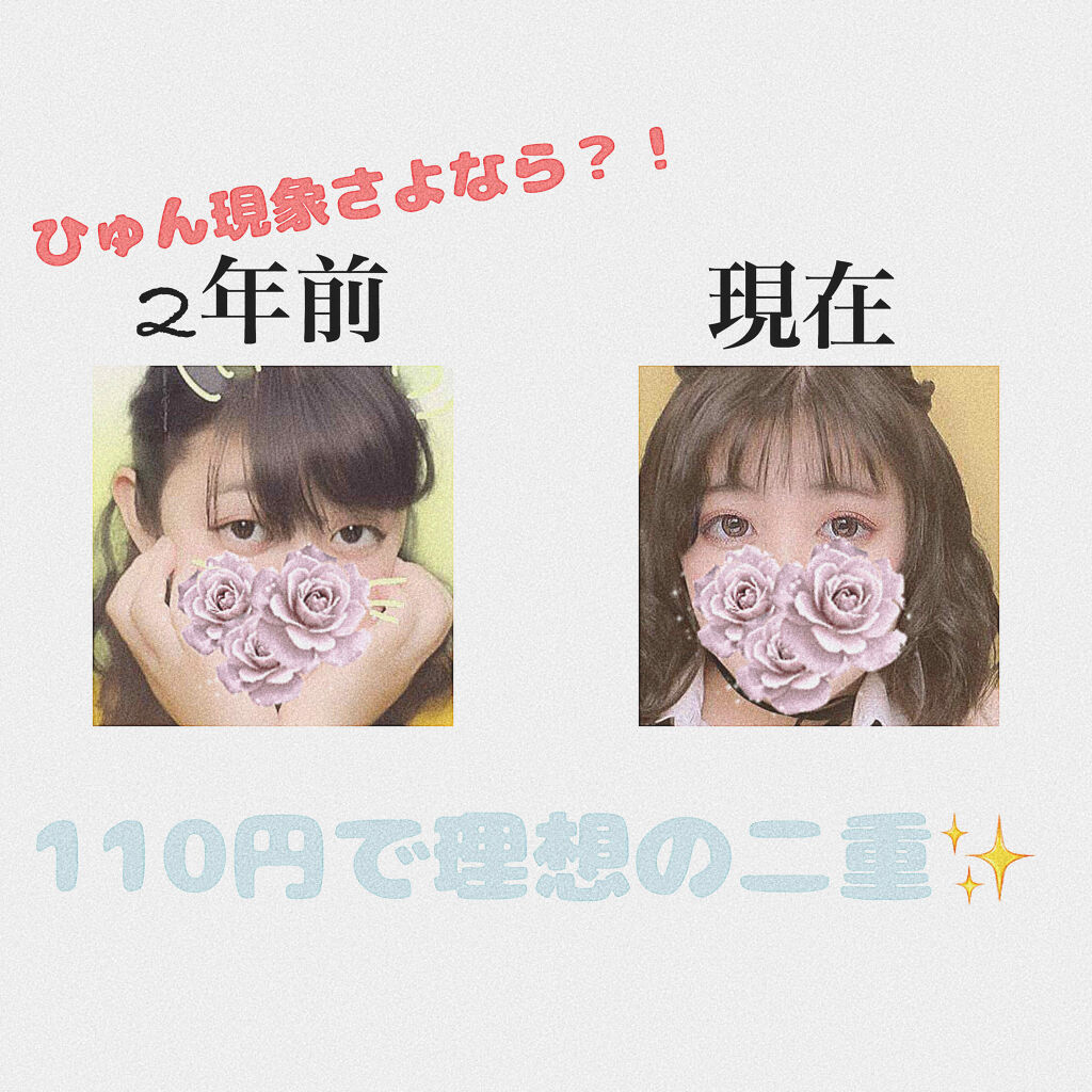 のびーるアイテープ（絆創膏タイプ、レギュラー）/DAISO/二重まぶた用アイテムを使ったクチコミ（1枚目）