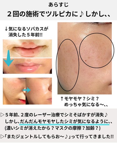 めがねちゃん_フォロバ🫶 on LIPS 「←こちらから過去のおすすめが見られます✨元化粧品研究者のめがね..」（3枚目）