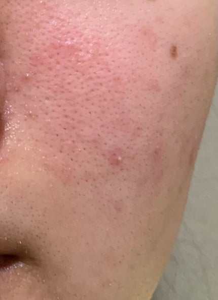 アミノ酸浸透ジェル/Mマークシリーズ/フェイスクリームを使ったクチコミ(2枚目)