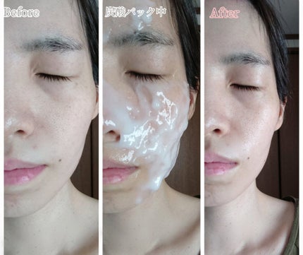 炭酸パック プルリ/ウツクシア/洗い流すパック・マスクを使ったクチコミ(10枚目)