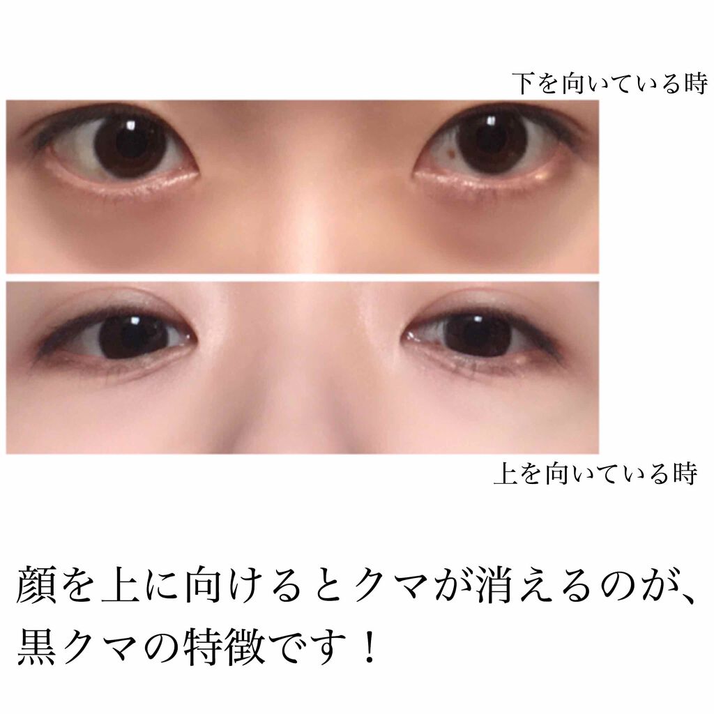 ラディアント タッチ/YVES SAINT LAURENT BEAUTE/リキッドコンシーラーを使ったクチコミ（2枚目）