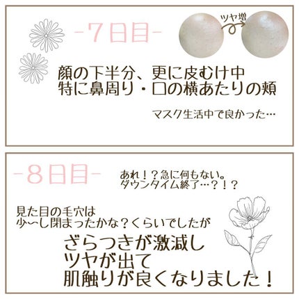 フェイシャル トリートメント エッセンス/SK-II/化粧水を使ったクチコミ(7枚目)