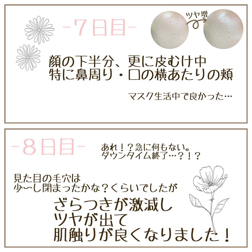 試してみた】MCダブルピーリングプロ リフトケアPLUS ミュゼ 試してみた】MCダブルピーリングプロ リフトケアPLUS ミュゼ