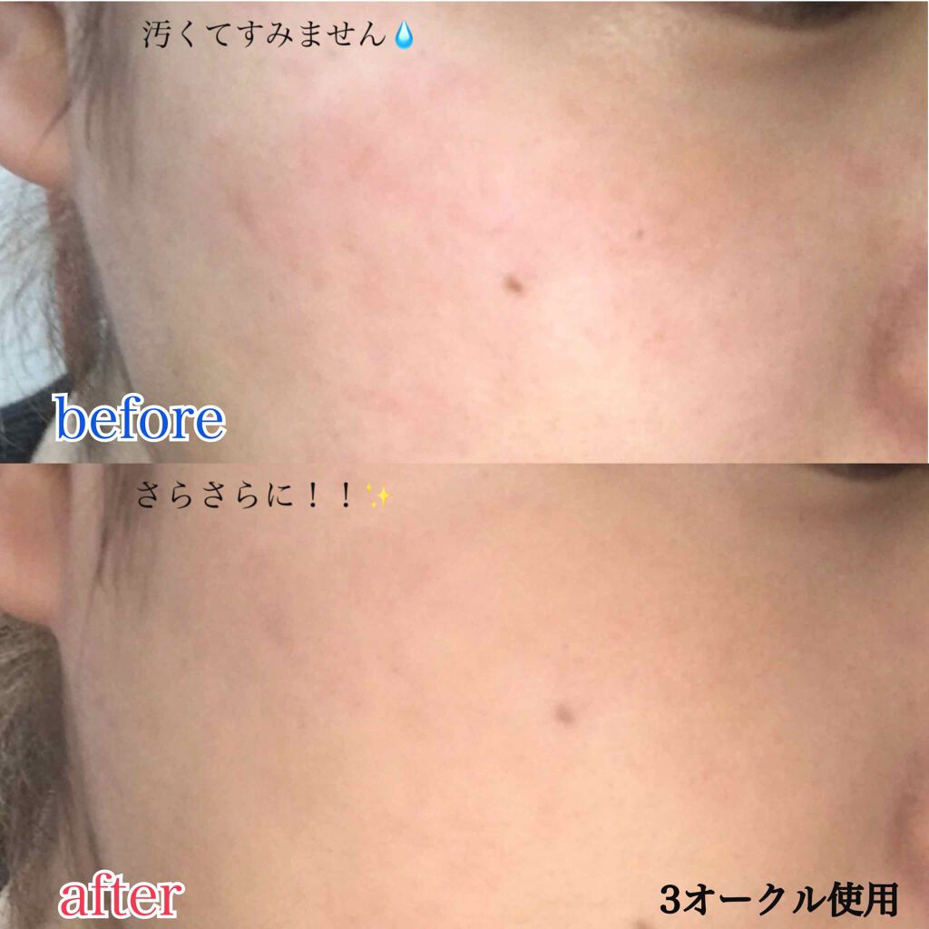 ウルトラカバー UV パクト/CEZANNE/パウダーファンデーションを使ったクチコミ(3枚目)