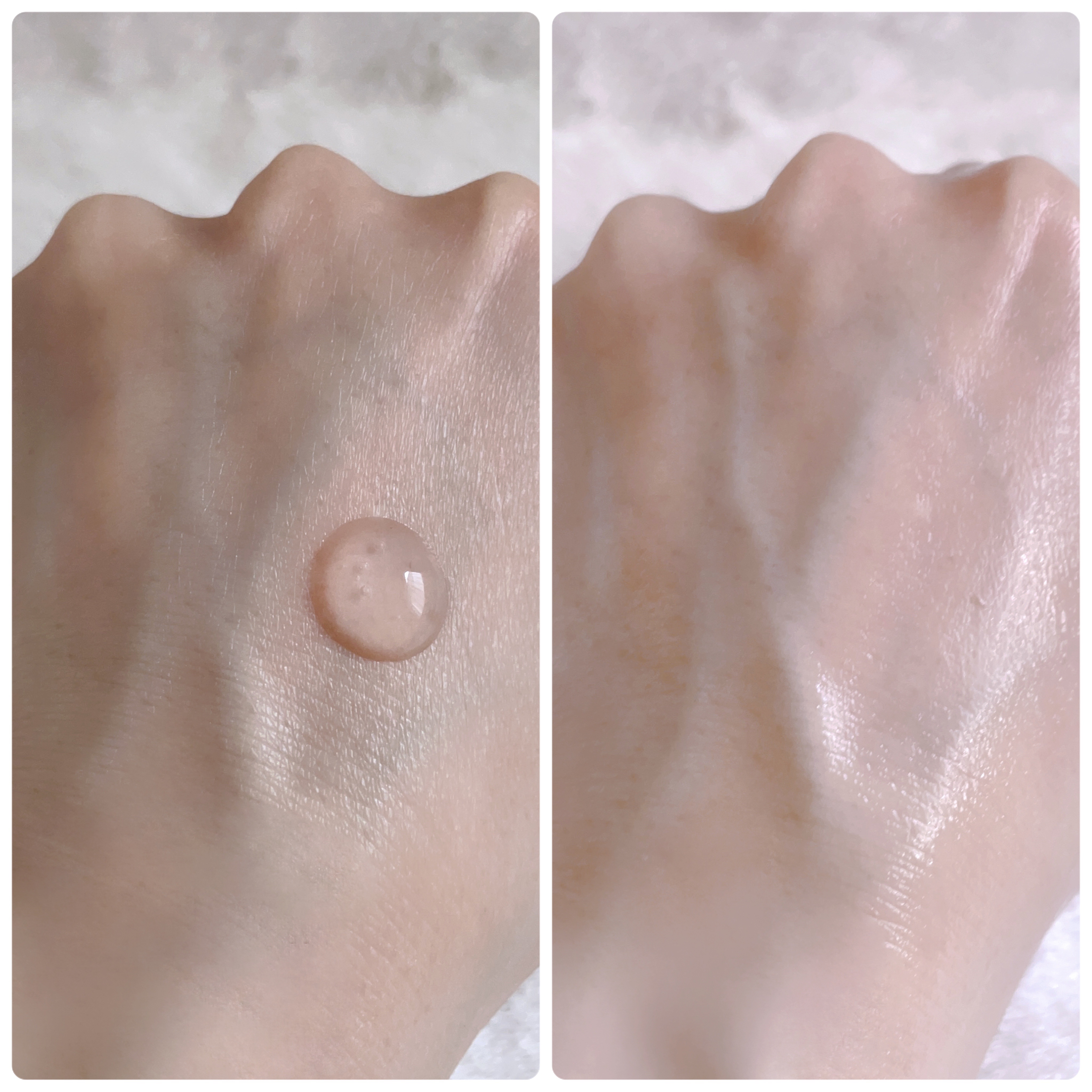 ピンクティーツリーシナジーセラム/APLIN/美容液を使ったクチコミ（3枚目）