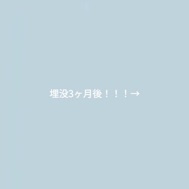 やづあ on LIPS 「先日、「二重整形戻った😭」みたいな投稿したんですけど、大丈夫で..」（1枚目）