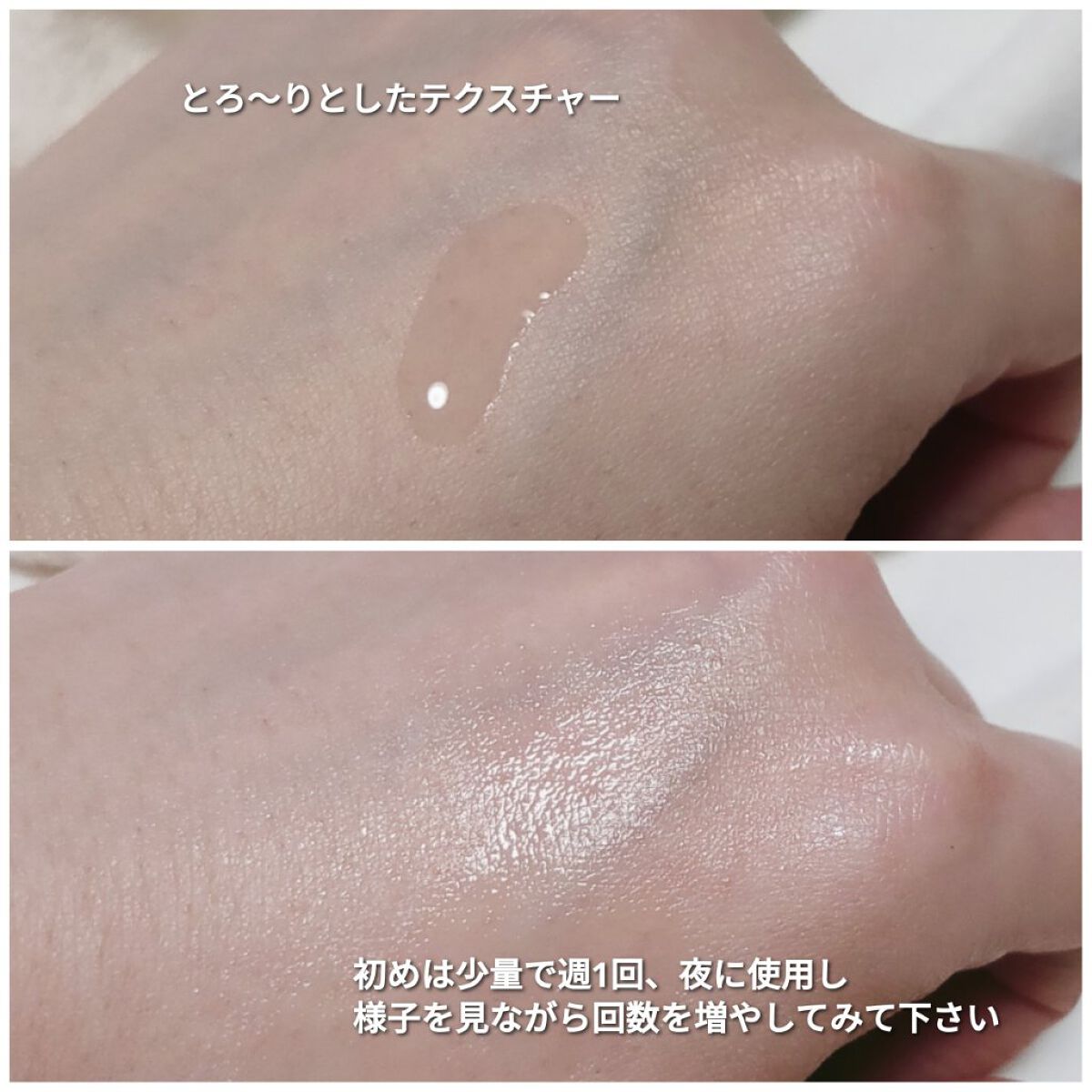 AZアゼライン酸10セラム/コスデバハ/美容液を使ったクチコミ(3枚目)