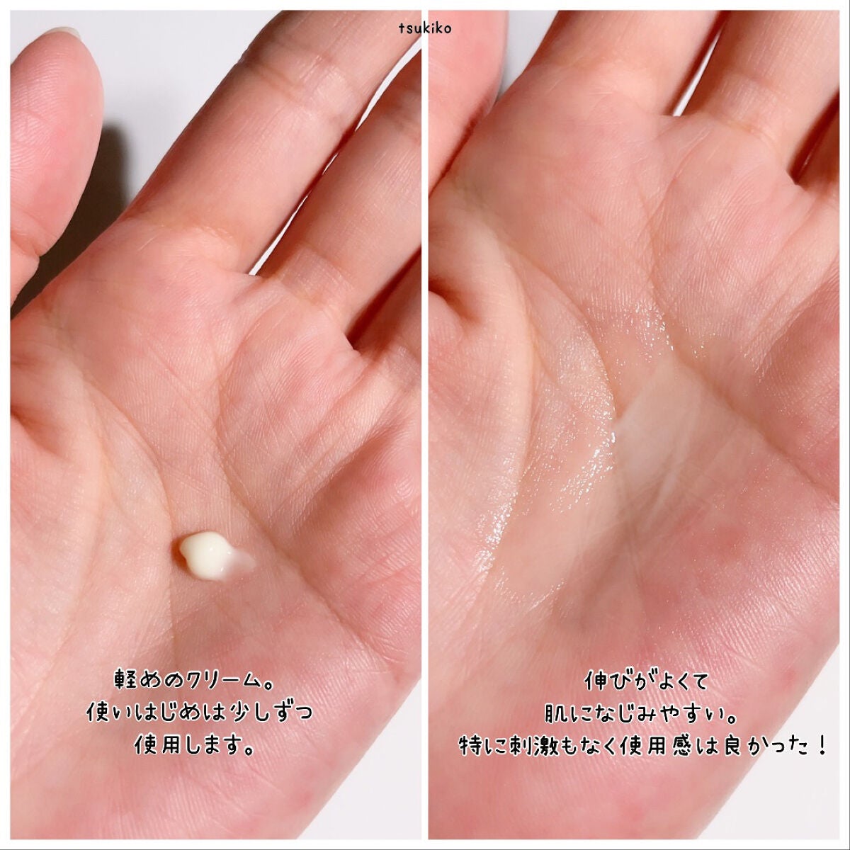 レチノール0.1%クリーム/Frankly/フェイスクリームを使ったクチコミ(4枚目)