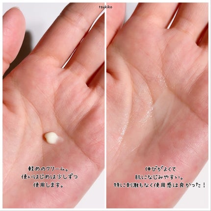 レチノール0.1%クリーム/Frankly/フェイスクリームを使ったクチコミ(4枚目)