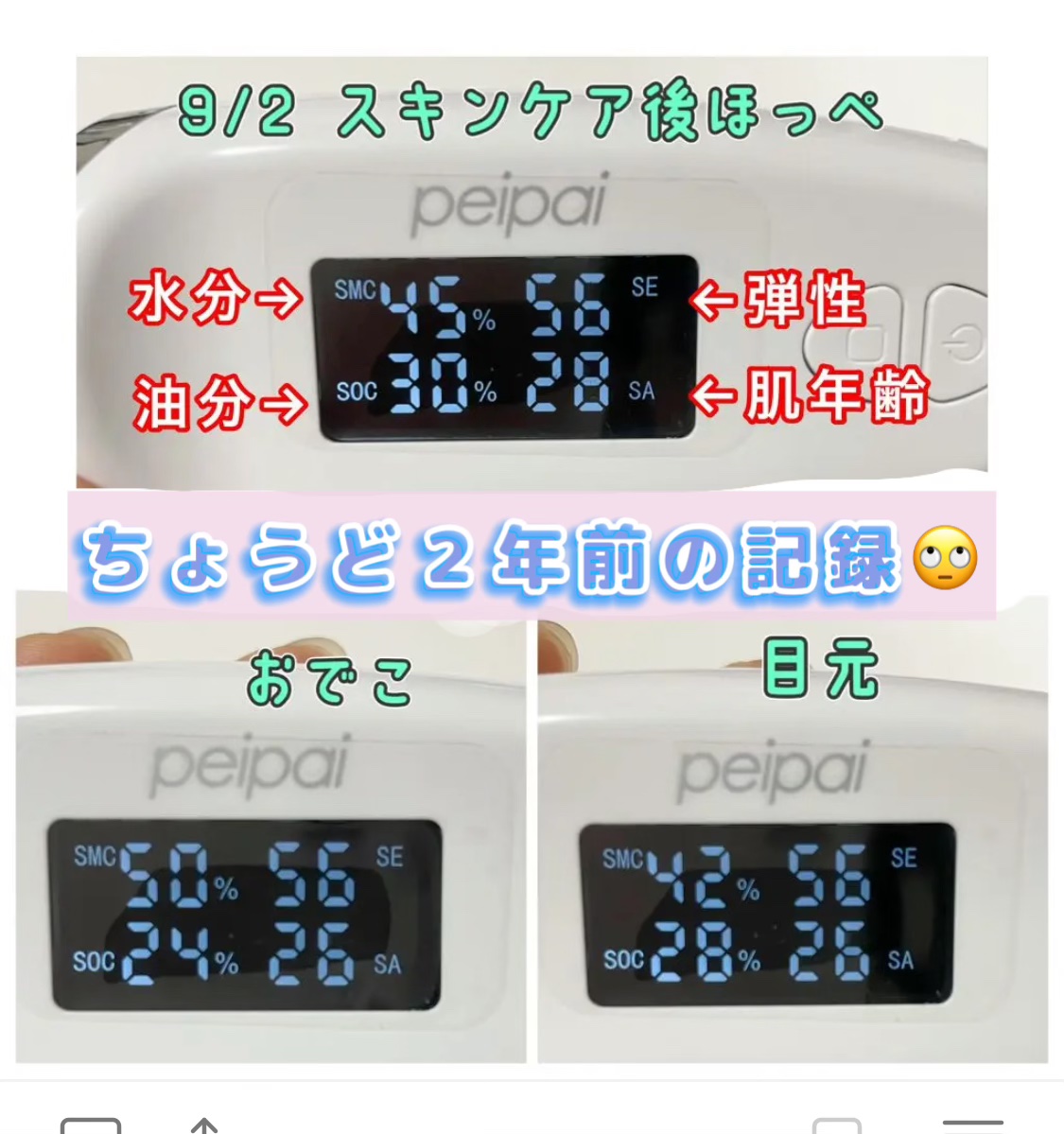 ごめんね素肌 キニナルマスク/クリアターン/シートマスク・パックを使ったクチコミ（3枚目）