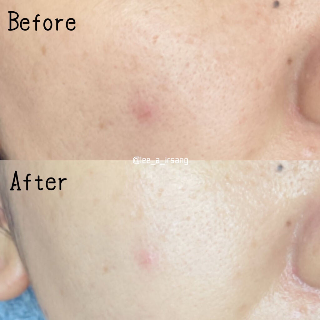 トラブルペアーマスク/DEWYCEL/シートマスク・パックを使ったクチコミ(5枚目)