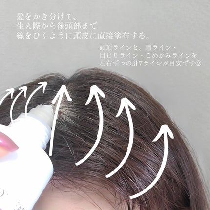 ムーンパール メディカルスカルプエッセンス/ミキモト コスメティックス/頭皮ローションを使ったクチコミ(3枚目)