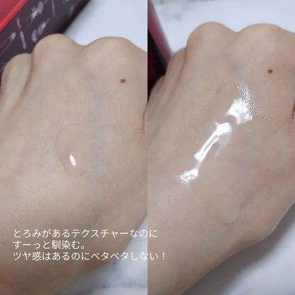 オイデルミン エッセンスローション/SHISEIDO/化粧水を使ったクチコミ(4枚目)