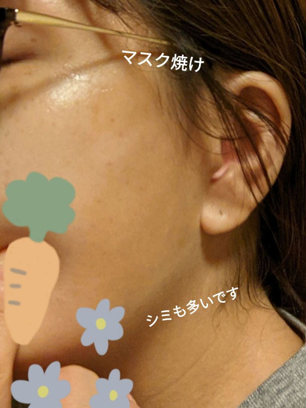 ビタミンC誘導体配合化粧水/ナリス化粧品/化粧水を使ったクチコミ(4枚目)