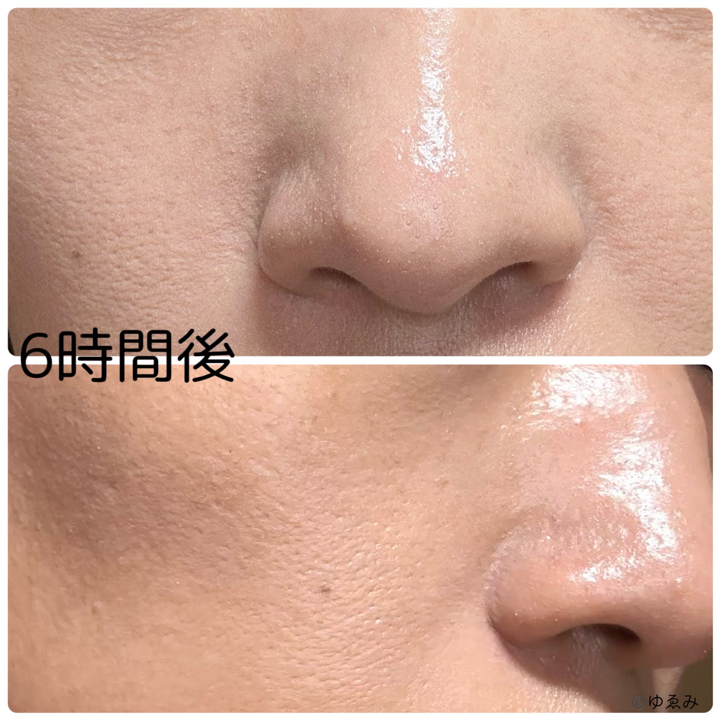 F5 リフレッシュクッション/keybo/クッションファンデーションを使ったクチコミ(4枚目)