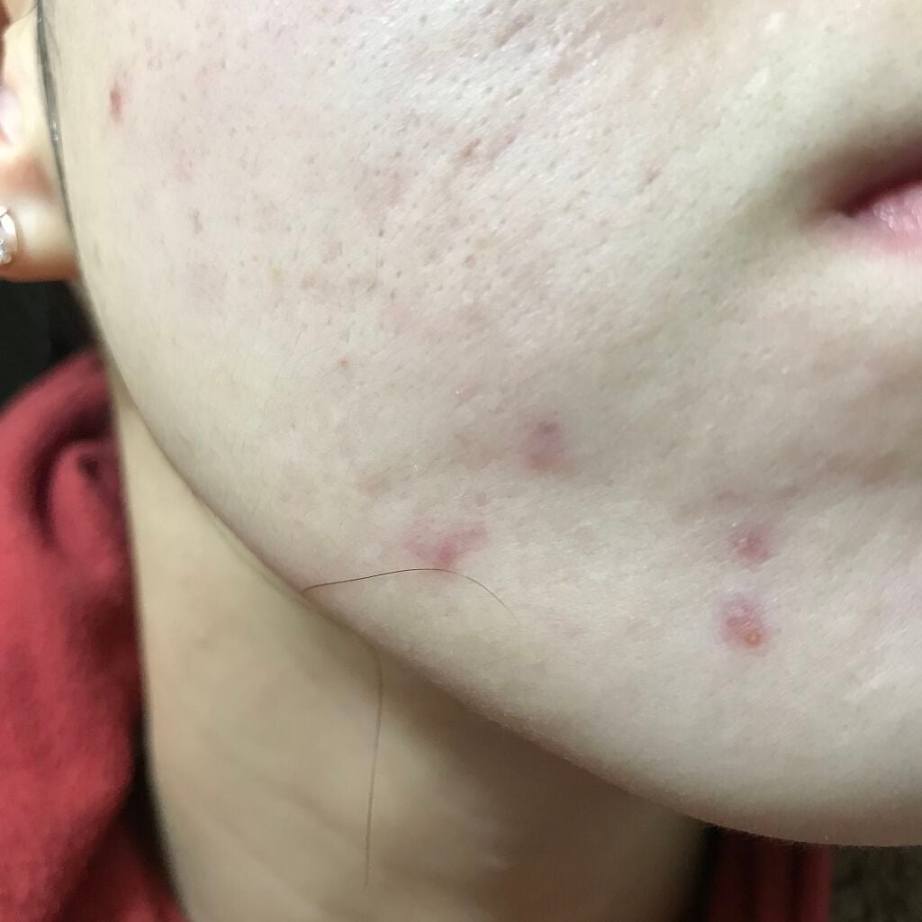 ラディアントクリーミーコンシーラー/NARS/リキッドコンシーラーを使ったクチコミ(3枚目)