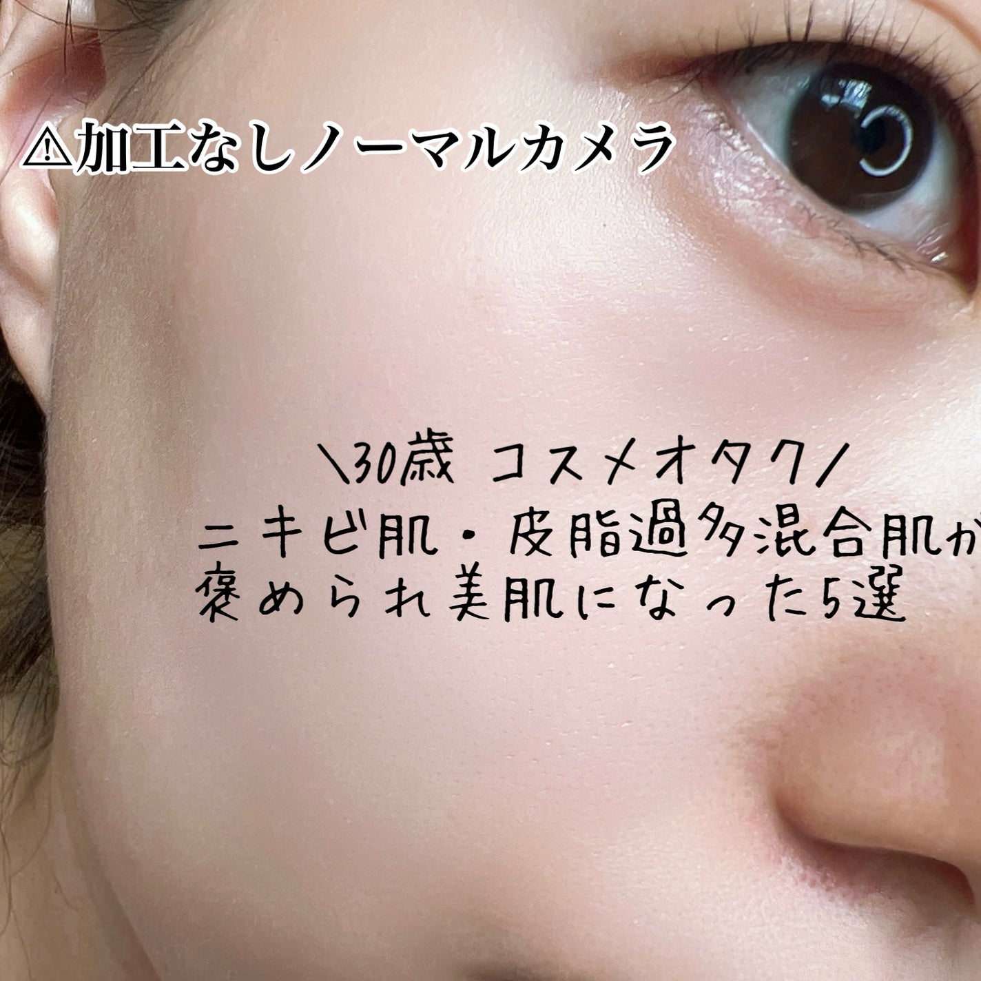 ティーツリーケア ソリューション エッセンシャルマスクEX/MEDIHEAL/シートマスク・パックを使ったクチコミ(1枚目)