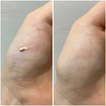 薬用スポットシーラークリーム/スキンヒーロー/クリームコンシーラーを使ったクチコミ(2枚目)