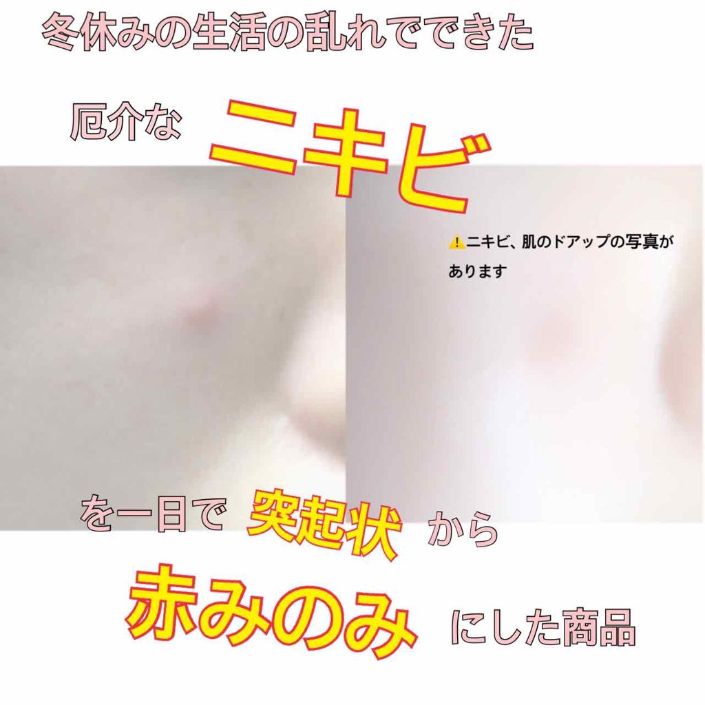 ACC パッチ/ETUDE/シートマスク・パックを使ったクチコミ（1枚目）