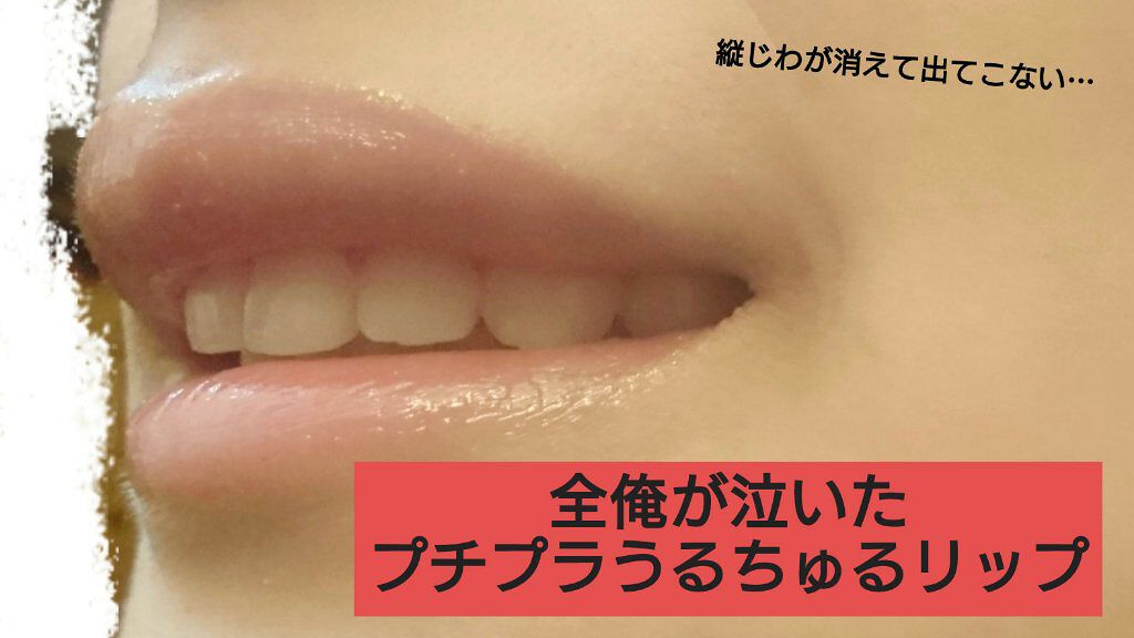 メルティクリームリップ/メンソレータム/リップクリームを使ったクチコミ(1枚目)