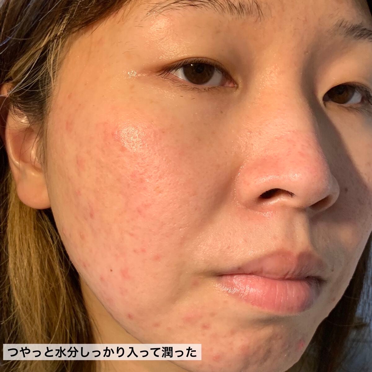 CICAトリプルリペアマスク /我的美麗日記/シートマスク・パックを使ったクチコミ(8枚目)