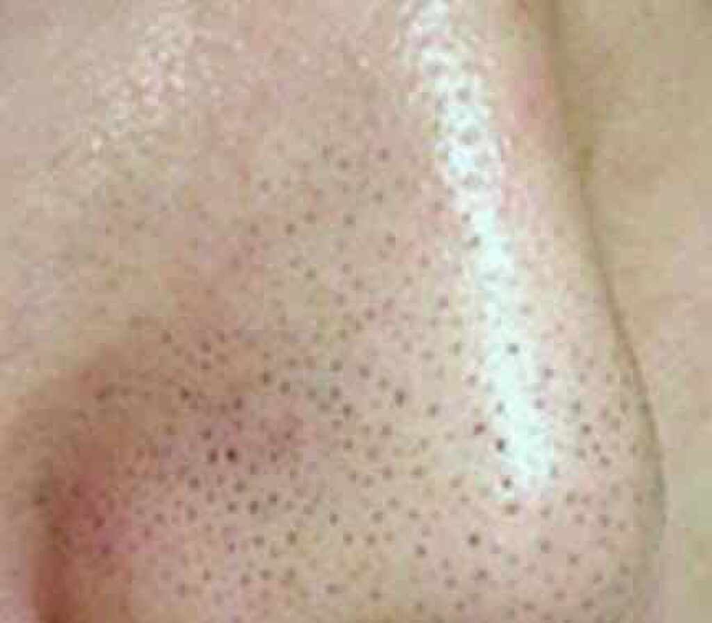 おうちdeエステ 肌をなめらかにする マッサージ洗顔ジェル/ビオレ/その他洗顔料を使ったクチコミ（2枚目）