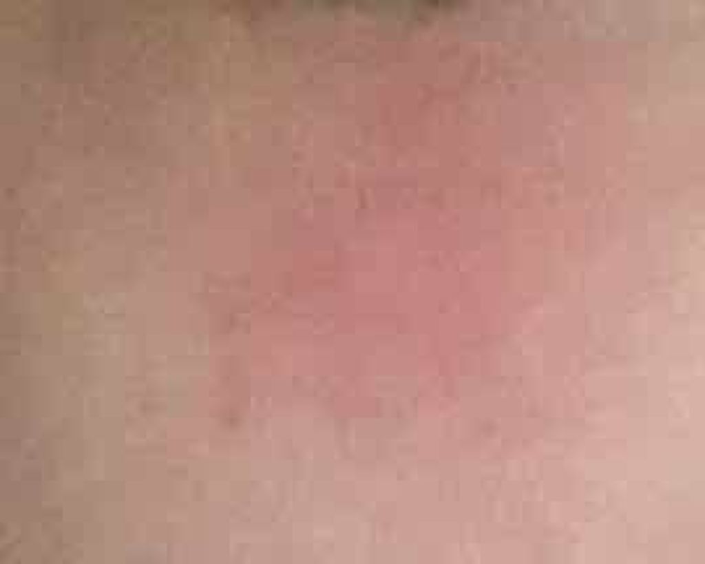 薬用アクネジェル/メンソレータム アクネス/美容液を使ったクチコミ（3枚目）