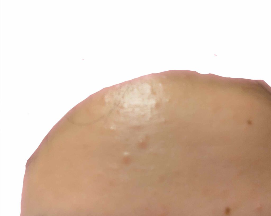 ペアA錠 (医薬品)/ペア/その他を使ったクチコミ（1枚目）