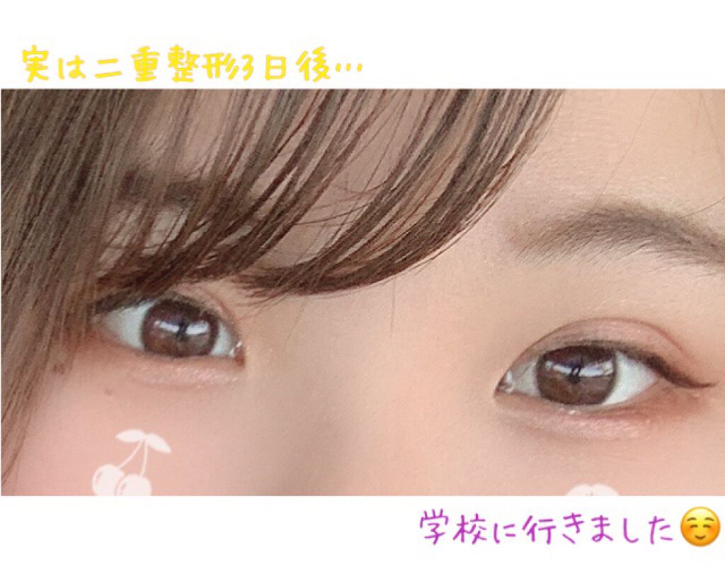 アイビューティー フィクサー WP/アストレア ヴィルゴ/二重まぶた用アイテムを使ったクチコミ(4枚目)