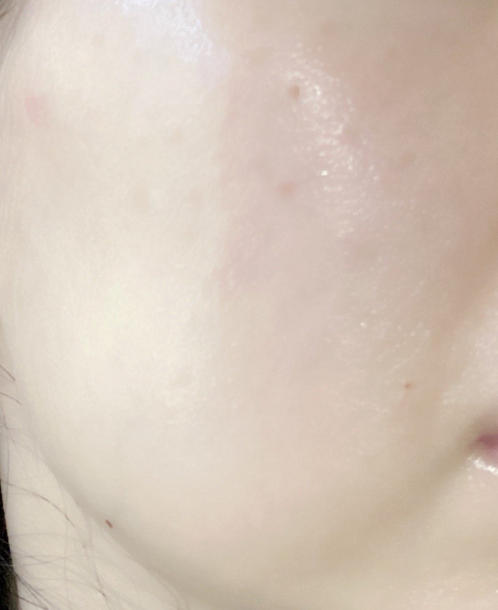 アルティミューン™ パワライジング コンセントレート Ⅲ/SHISEIDO/美容液を使ったクチコミ(1枚目)