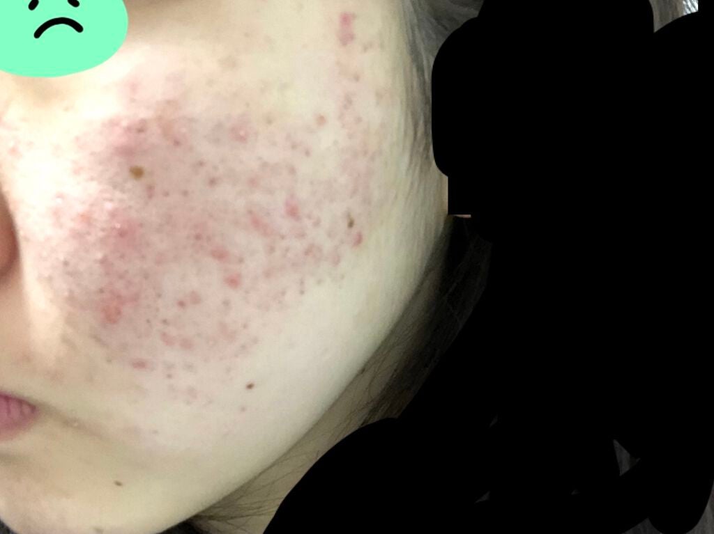 デュオ ザ クレンジングバーム/DUO/クレンジングバームを使ったクチコミ(5枚目)