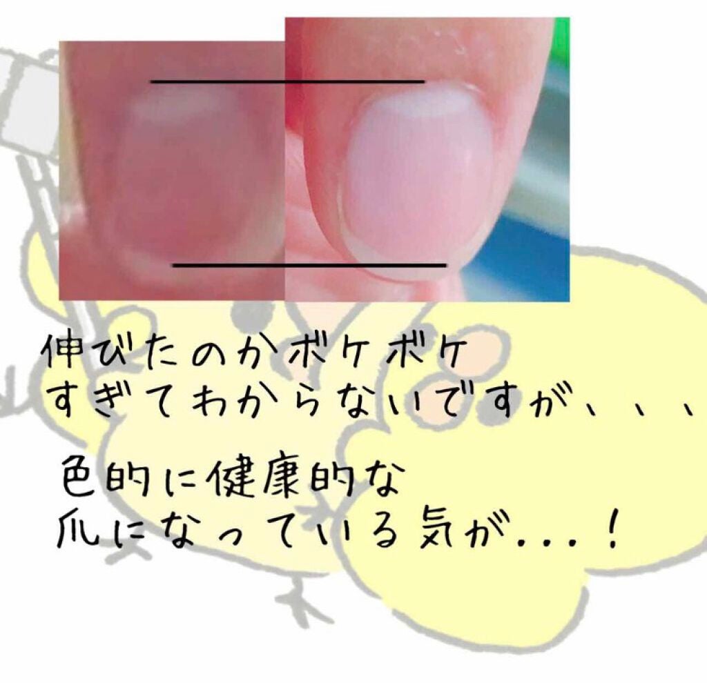 ウィンマックス キューティクルオイル/DAISO/ネイルオイル・トリートメントを使ったクチコミ(2枚目)