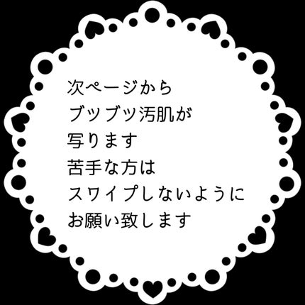 V エッセンス/unlabel/美容液を使ったクチコミ(2枚目)