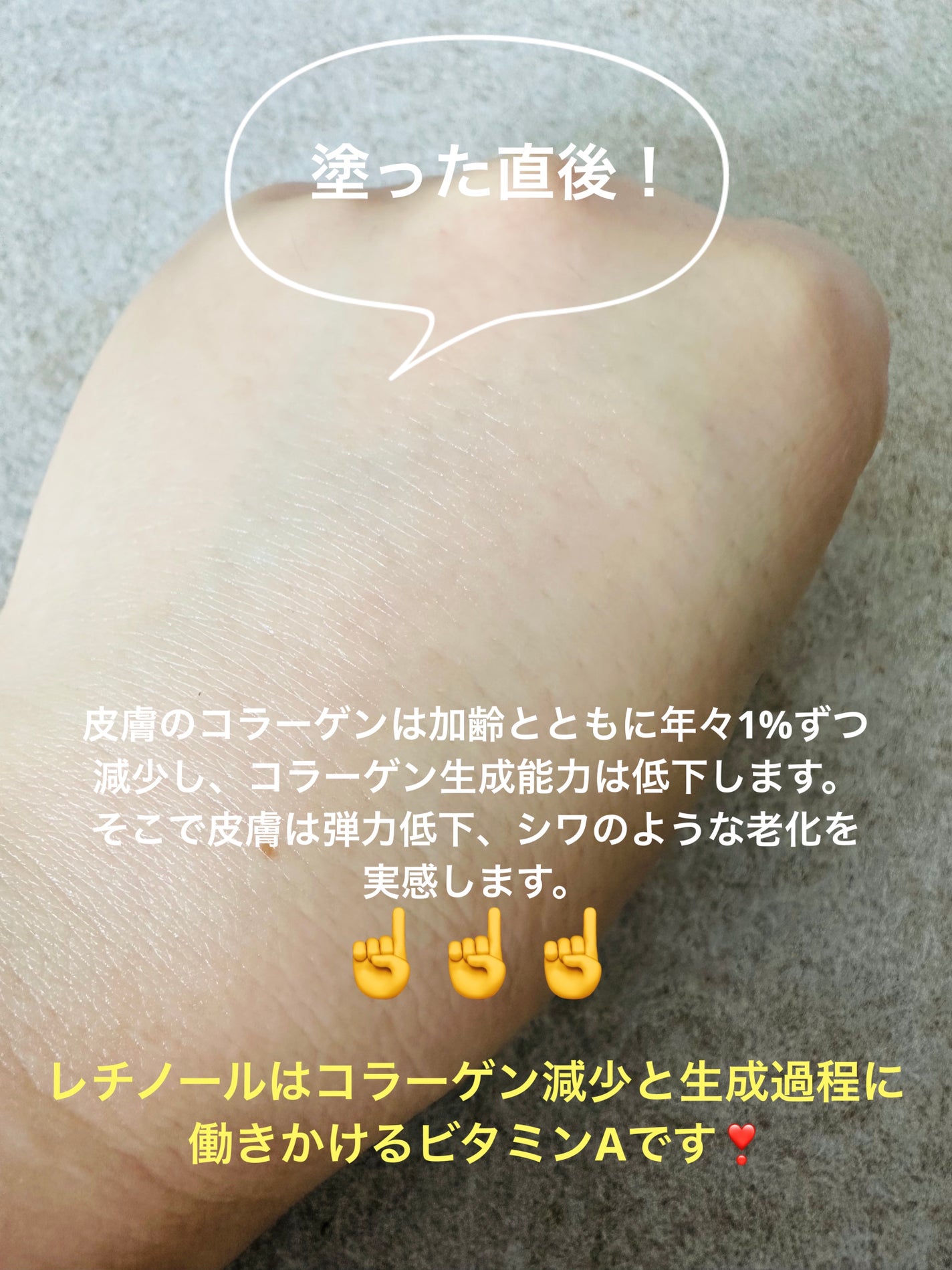 レチノール エキスパート 0.3%/IOPE/美容液を使ったクチコミ(4枚目)