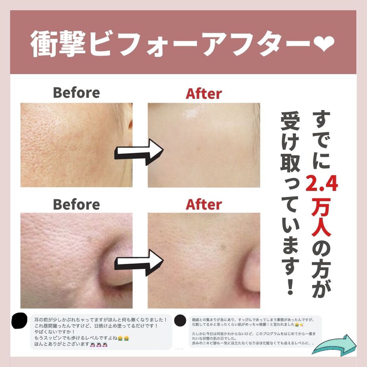 あなたの肌に合ったスキンケア💐コーくん先生 on LIPS 「【本当は教えたくない】毛穴の開きコレで消えます🔥.
.
あなた..」(8枚目)