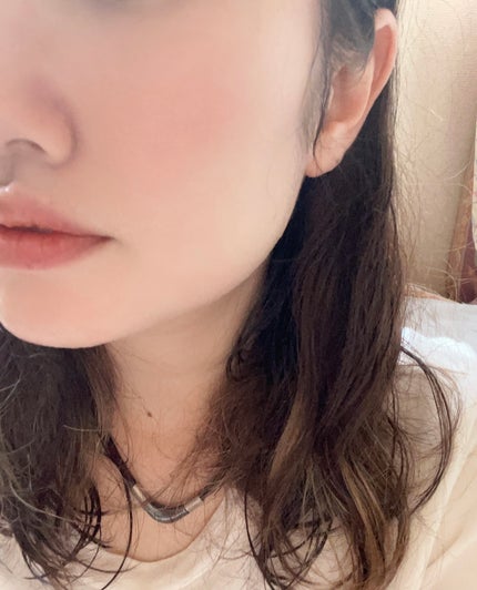 ピンクティーツリートナー/APLIN/化粧水を使ったクチコミ(3枚目)