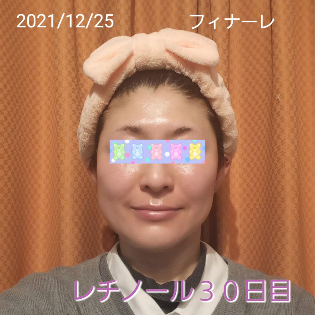 モイスチャーバーム ジャー/キュレル/フェイスクリームを使ったクチコミ（1枚目）