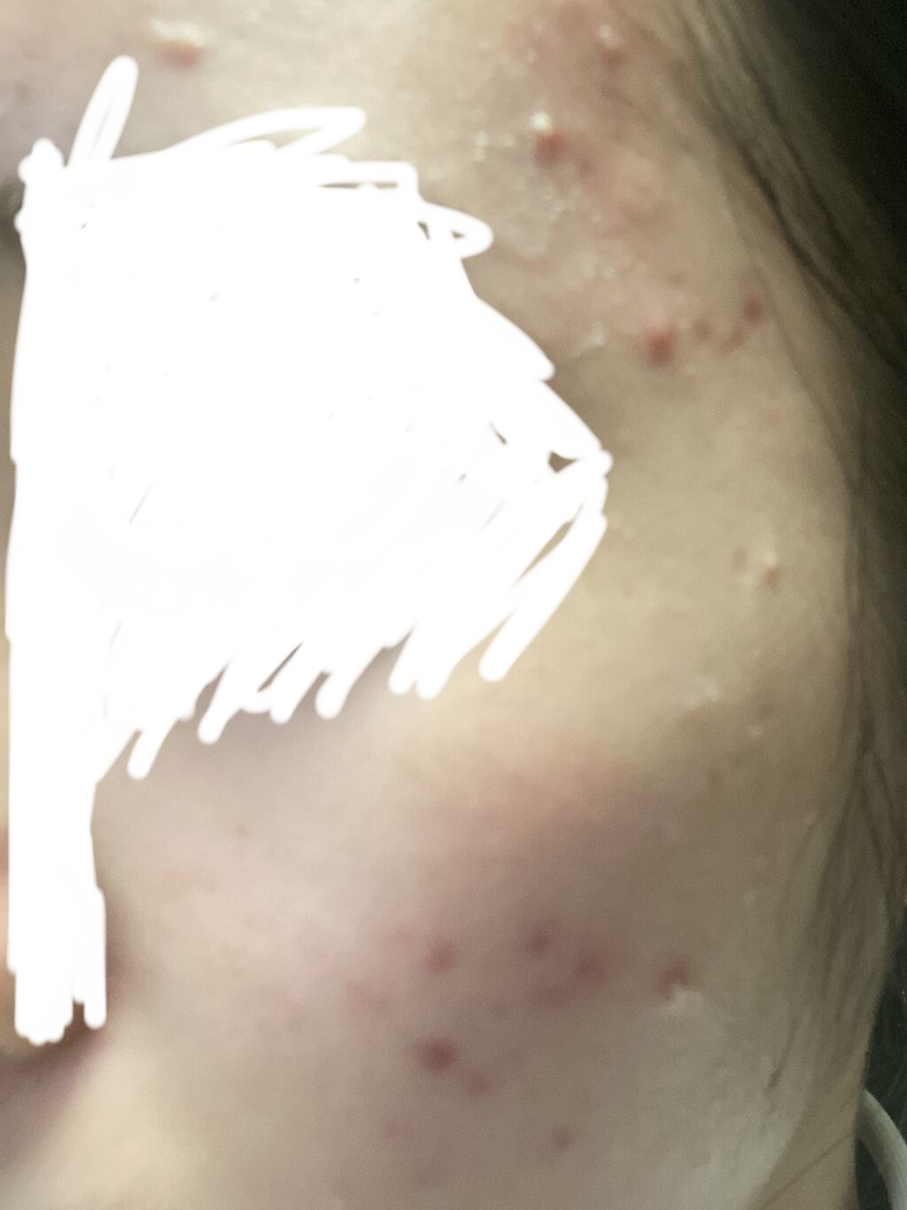 グリーン ダーマCICAビックトナー/ネイチャーリパブリック/化粧水を使ったクチコミ（2枚目）