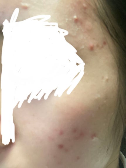 グリーン ダーマCICAビックトナー/ネイチャーリパブリック/化粧水を使ったクチコミ(2枚目)