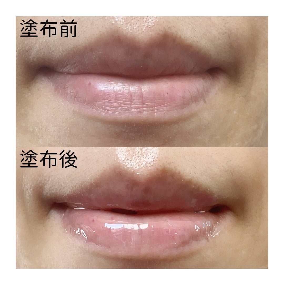 エスト ザ リップセラム/est/リップ美容液を使ったクチコミ(3枚目)