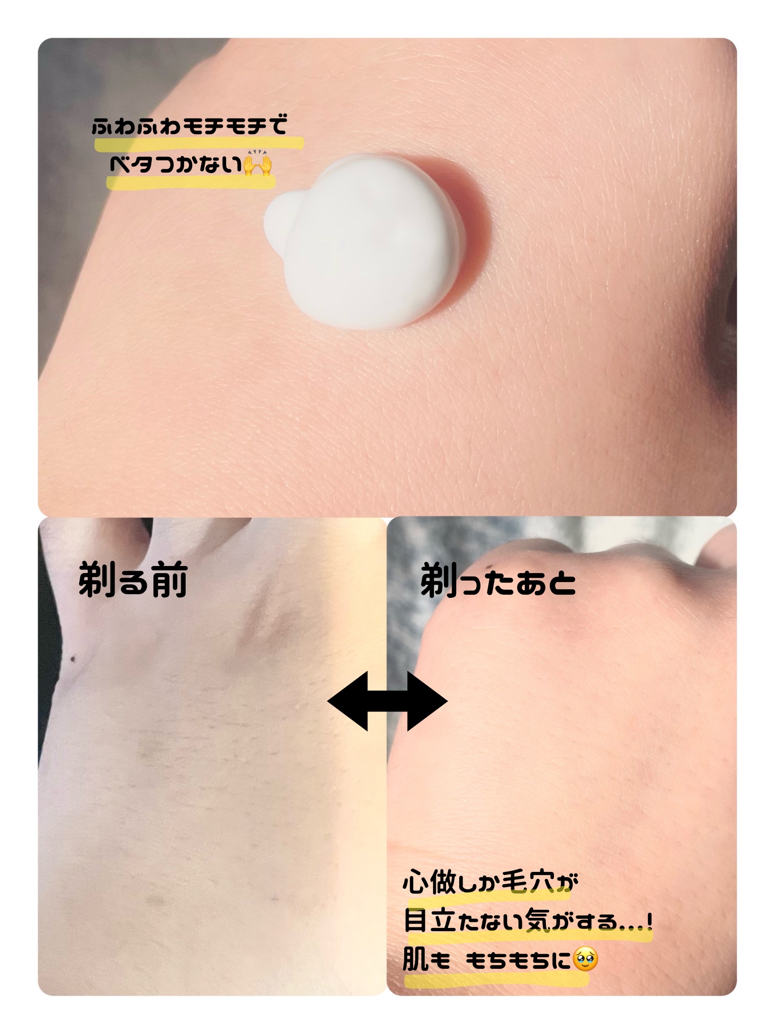 サロンプラス V.I.Oダブルシェーバー/サロンプラス/シェーバーを使ったクチコミ（2枚目）