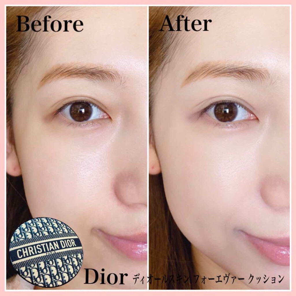 ディオールスキン フォーエヴァー クッション ディオールマニア エディション/Dior/クッションファンデーションを使ったクチコミ(2枚目)