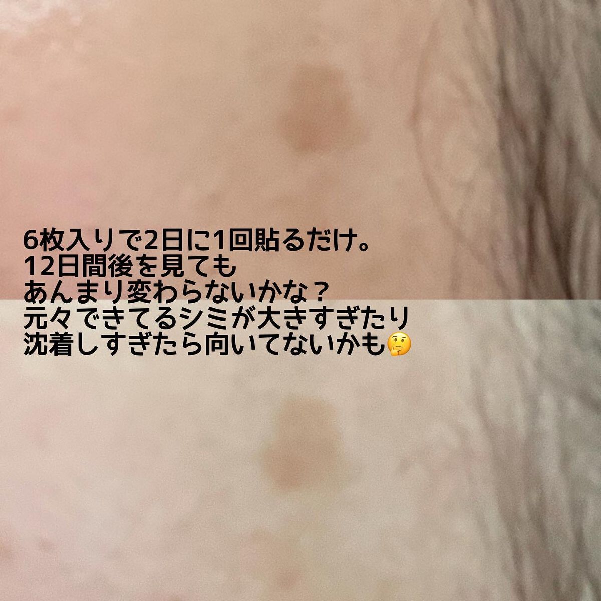 ディープビタCパッチ/MEDICUBE/その他スキンケアを使ったクチコミ（3枚目）